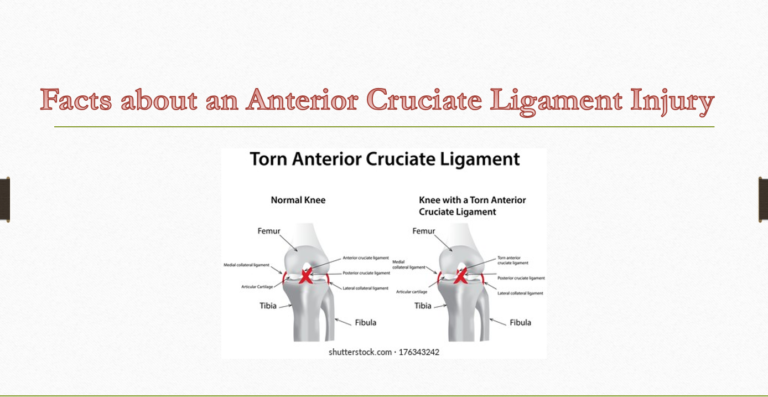 Researching the Anterior Cruciate Ligament