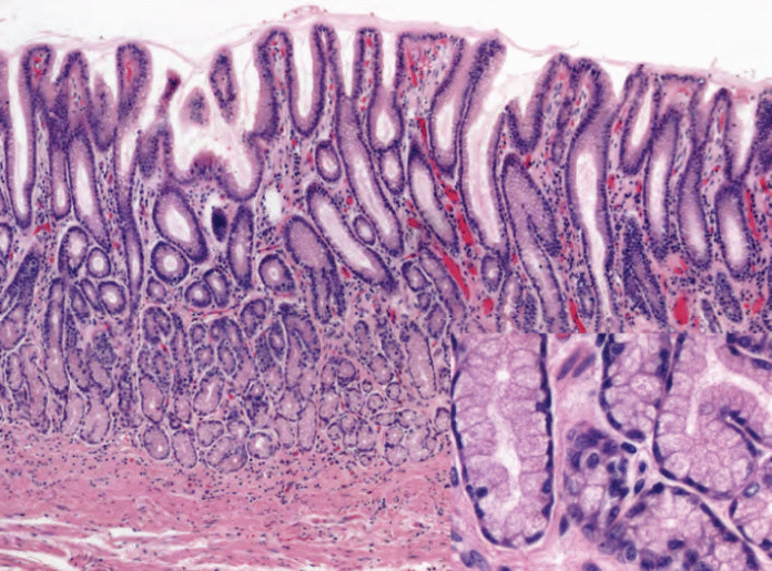 Normal Antrum Visual Microscopic Masterpiece - Charged Magazine